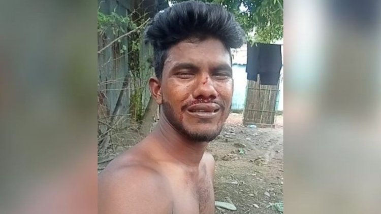 মুন্সীগঞ্জে যুবককে হাতুড়ি দিয়ে পেটালেন ওয়ার্ড আওয়ামী লীগ নেতা