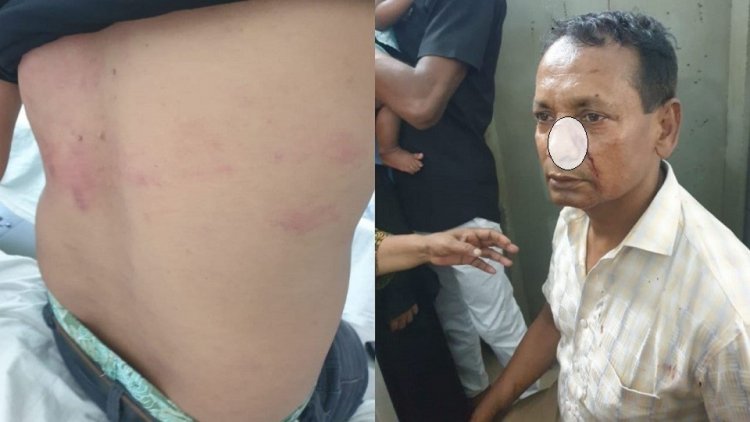 মাদরাসার আয়-ব্যয়ের হিসাব চাওয়াকে কেন্দ্র করে হামলা, আহত ৪